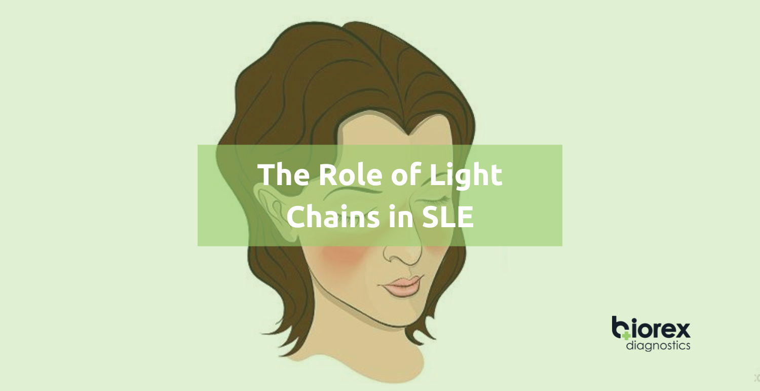 The Role of Light Chains in SLE Blog Banner